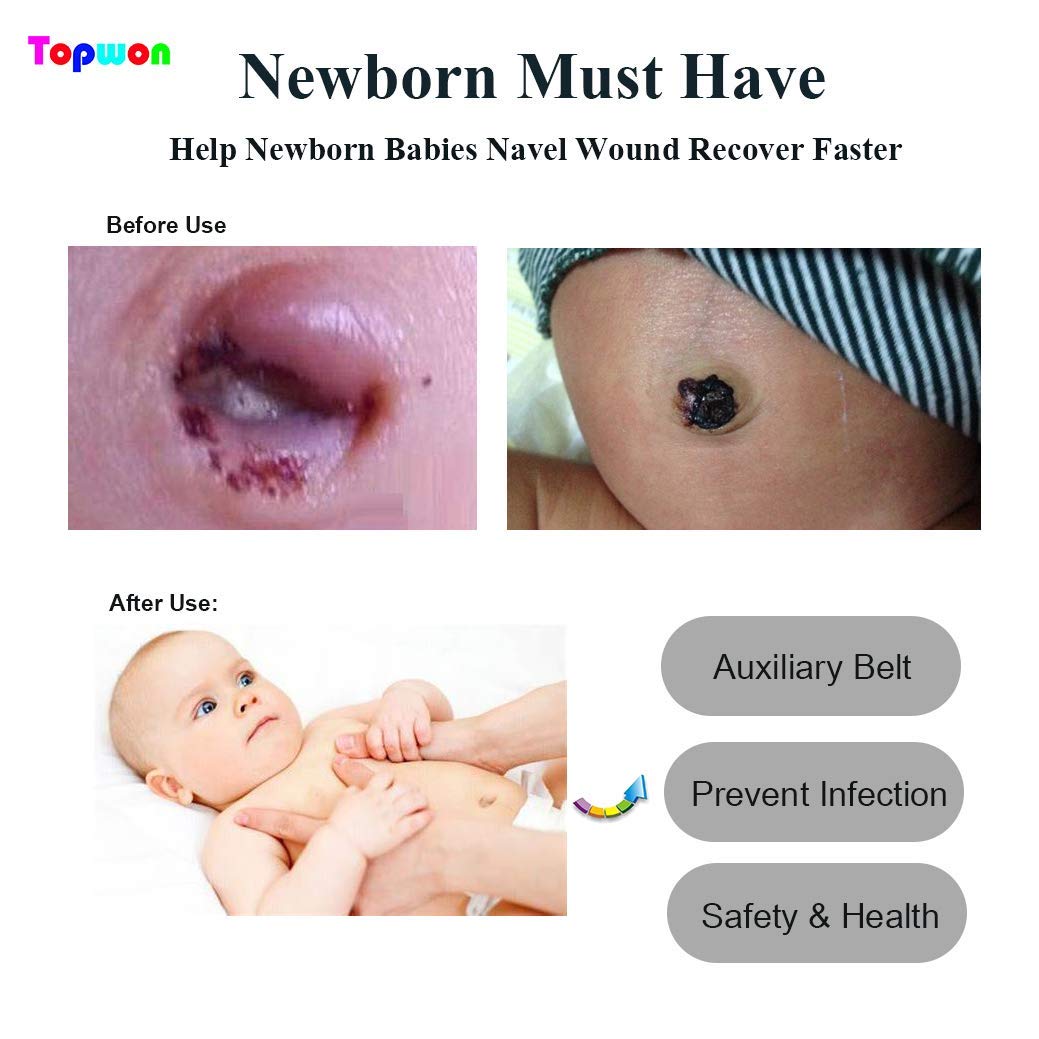 Topwon 10 Pcs Baby Belly Band Newborn Belly Binder Infant Umbilical Cord Band Belly Button Warp Registry Must Haves Gift Cotton - Image 5